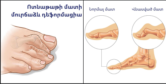 լույս բարրի վերականգնողական կենտրոն