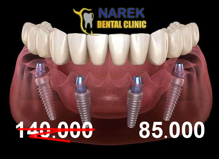 narek dental clinic