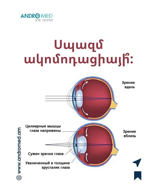 անդրոմեդ ակնաբուժական կենտրոն andromed