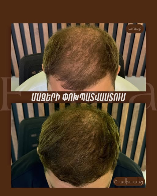 evera clinic էվերա քլինիք էսթետիկ բժշկության կենտրոն